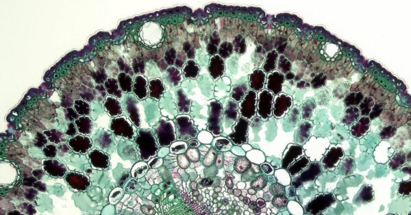 Colorful microscopic view of cells from mouse organs showing aging changes