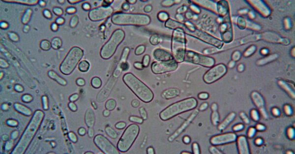 Microscopic view of archaea microbe that repurposes genetic stop codon for pyrrolysine amino acid