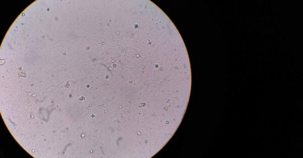 Microscopic image of engineered bacteria invading a cancer tumor